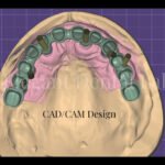 cad cam design