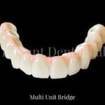 multiunitbridge