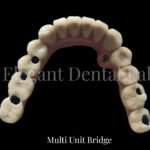 multiunitbridge 2