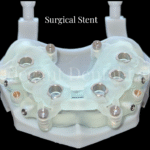 surgical stent
