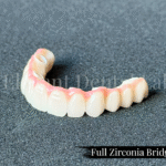 full zirconia bridge