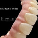 full zirconia bridge 2