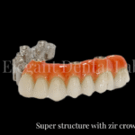super structure with zir crowns 2
