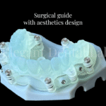 surfical guide with aesthetics design