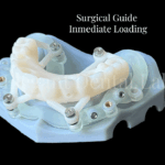surgical guide inmmedate loading